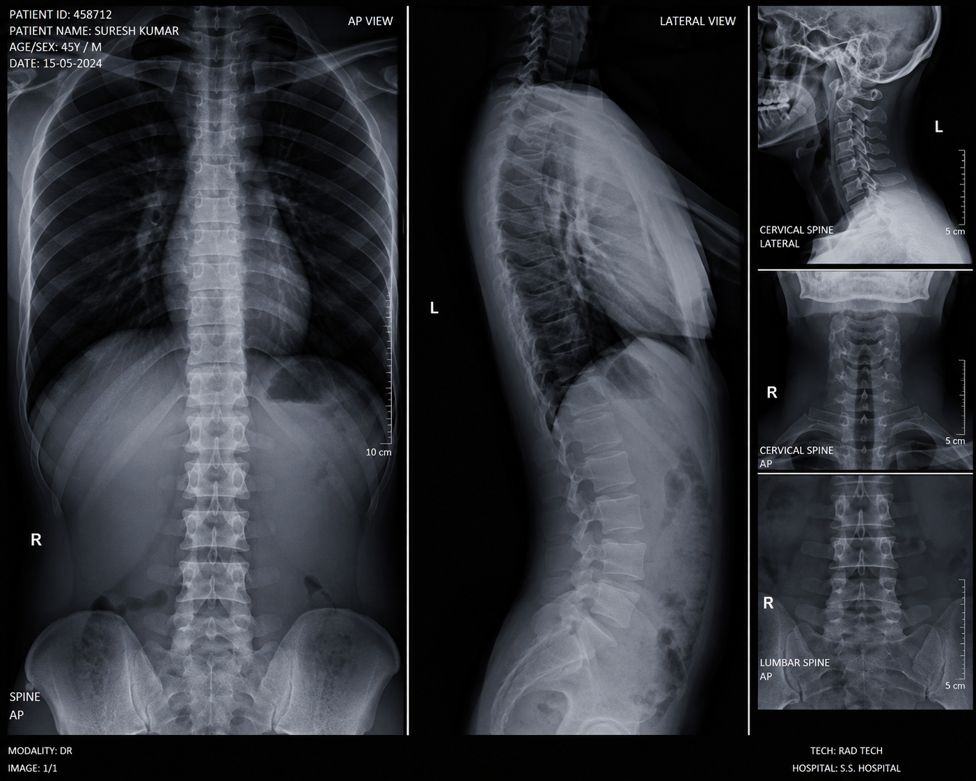 Medical diagnostic equipment